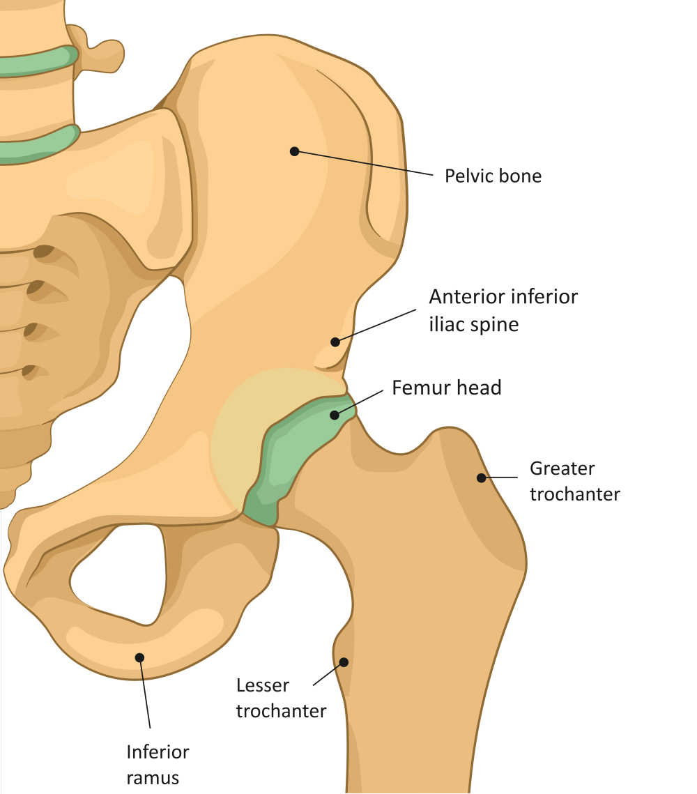 Femoroacetabular Impingement (FAI)