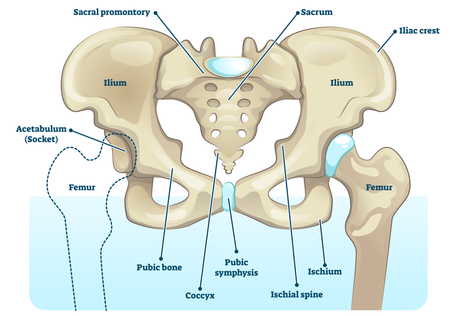 Ischiofemoral Impingement